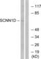 Sodium Channel Epithelial 1 Delta Subunit antibody, LS-C119717, Lifespan Biosciences, Western Blot image 