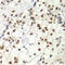 MutS Homolog 6 antibody, 13-352, ProSci, Immunohistochemistry frozen image 