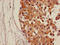 Cadherin 18 antibody, orb400644, Biorbyt, Immunohistochemistry paraffin image 