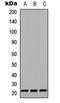 Colony Stimulating Factor 3 antibody, LS-C355981, Lifespan Biosciences, Western Blot image 