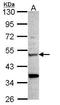 Chitinase 1 antibody, TA308046, Origene, Western Blot image 