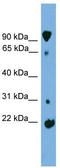 Kelch Like Family Member 2 antibody, TA340166, Origene, Western Blot image 