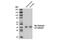 Sodium Voltage-Gated Channel Beta Subunit 2 antibody, 13966S, Cell Signaling Technology, Western Blot image 