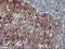 Interleukin-1 alpha antibody, M01144-1, Boster Biological Technology, Immunohistochemistry paraffin image 