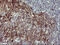 Interleukin 1 Alpha antibody, M01144-1, Boster Biological Technology, Immunohistochemistry paraffin image 