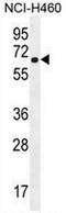 Cholinergic Receptor Nicotinic Delta Subunit antibody, AP50909PU-N, Origene, Western Blot image 