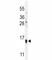 Melan-A antibody, F41628-0.4ML, NSJ Bioreagents, Western Blot image 