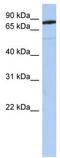 Semaphorin-4B antibody, TA338408, Origene, Western Blot image 