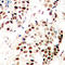 Snail Family Transcriptional Repressor 1 antibody, LS-C368512, Lifespan Biosciences, Immunohistochemistry paraffin image 