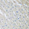 Mixed lineage kinase domain-like protein antibody, LS-C748499, Lifespan Biosciences, Immunohistochemistry paraffin image 