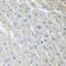 Mixed Lineage Kinase Domain Like Pseudokinase antibody, LS-C748499, Lifespan Biosciences, Immunohistochemistry paraffin image 