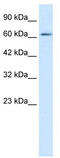 Zinc Finger Protein 649 antibody, TA339543, Origene, Western Blot image 