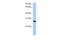 Epithelial Cell Transforming 2 antibody, PA5-43811, Invitrogen Antibodies, Western Blot image 