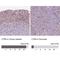 CTR9 Homolog, Paf1/RNA Polymerase II Complex Component antibody, NBP2-49547, Novus Biologicals, Immunohistochemistry paraffin image 