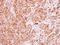 Cholinergic Receptor Nicotinic Beta 1 Subunit antibody, GTX114323, GeneTex, Immunohistochemistry paraffin image 