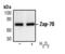 Zeta Chain Of T Cell Receptor Associated Protein Kinase 70 antibody, MA5-15180, Invitrogen Antibodies, Western Blot image 