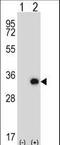 Testis Specific Serine Kinase 6 antibody, LS-C164595, Lifespan Biosciences, Western Blot image 