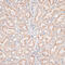 Glypican 3 antibody, 15-307, ProSci, Immunohistochemistry paraffin image 