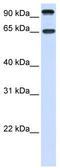 Neurotrophic Receptor Tyrosine Kinase 3 antibody, TA339188, Origene, Western Blot image 