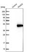 Radical S-Adenosyl Methionine Domain Containing 2 antibody, PA5-59457, Invitrogen Antibodies, Western Blot image 