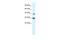 Interferon Regulatory Factor 2 antibody, 31-154, ProSci, Western Blot image 