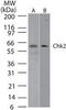 Checkpoint Kinase 2 antibody, MA1-41250, Invitrogen Antibodies, Western Blot image 