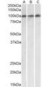 VPS16 Core Subunit Of CORVET And HOPS Complexes antibody, LS-B12243, Lifespan Biosciences, Western Blot image 
