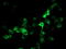 Cytochrome P450 Family 2 Subfamily J Member 2 antibody, LS-C786393, Lifespan Biosciences, Immunofluorescence image 