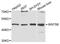 Wnt Family Member 5B antibody, A8313, ABclonal Technology, Western Blot image 