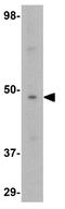 GATA Binding Protein 3 antibody, GTX31401, GeneTex, Western Blot image 