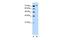 Rho Related BTB Domain Containing 1 antibody, GTX47103, GeneTex, Western Blot image 