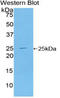 Toll Like Receptor Adaptor Molecule 2 antibody, LS-C296710, Lifespan Biosciences, Western Blot image 