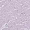 Troponin C2, Fast Skeletal Type antibody, PA5-63577, Invitrogen Antibodies, Immunohistochemistry frozen image 