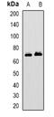 Mitochondrial Antiviral Signaling Protein antibody, abx225284, Abbexa, Western Blot image 