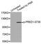 Serine/threonine-protein kinase D1 antibody, LS-C335820, Lifespan Biosciences, Western Blot image 