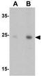 Dorsal Root Ganglia Homeobox antibody, GTX32035, GeneTex, Western Blot image 