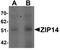 Solute Carrier Family 39 Member 14 antibody, A04761, Boster Biological Technology, Western Blot image 