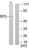 Sp2 Transcription Factor antibody, LS-C118977, Lifespan Biosciences, Western Blot image 