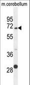 Glypican 5 antibody, LS-C166601, Lifespan Biosciences, Western Blot image 