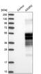 Asialoglycoprotein Receptor 2 antibody, PA5-53249, Invitrogen Antibodies, Western Blot image 