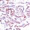 Activating Transcription Factor 2 antibody, 79-114, ProSci, Immunohistochemistry paraffin image 