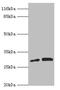 Proteasome Inhibitor Subunit 1 antibody, LS-C676330, Lifespan Biosciences, Western Blot image 