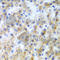 Lymphocyte Antigen 86 antibody, A6185, ABclonal Technology, Immunohistochemistry paraffin image 