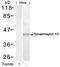 Synaptotagmin 2 antibody, 79-610, ProSci, Western Blot image 