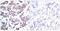 Myocyte Enhancer Factor 2A antibody, AP02340PU-N, Origene, Immunohistochemistry paraffin image 