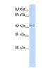 Transmembrane Protein 248 antibody, NBP1-79208, Novus Biologicals, Western Blot image 