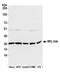 Ribosomal Protein L10a antibody, A305-062A, Bethyl Labs, Western Blot image 
