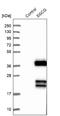 Sarcoglycan Gamma antibody, NBP1-90299, Novus Biologicals, Western Blot image 