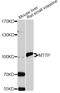 Microsomal Triglyceride Transfer Protein antibody, MBS127912, MyBioSource, Western Blot image 