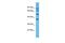 Pseudouridine Synthase 7 Like antibody, PA5-46607, Invitrogen Antibodies, Western Blot image 